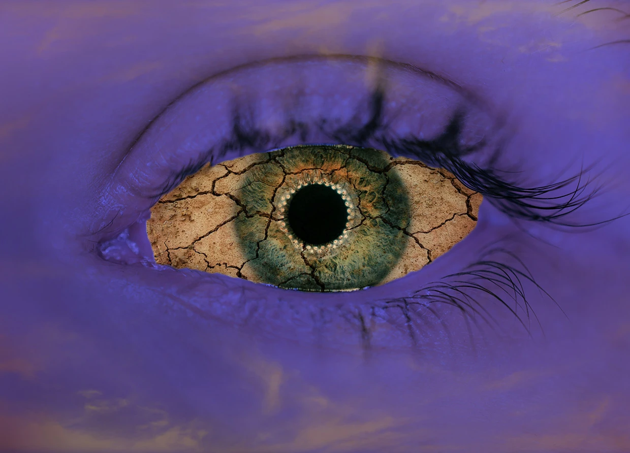 DON'T FORGET TO BLINK: TIPS TO TREAT DRY EYES