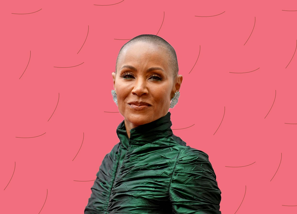 ALOPECIA AREATA-- AN AUTOIMMUNE DISORDER THAT CAUSES SEVERE HAIR LOSS AND BALDING ON JADA PINKETT SMITH